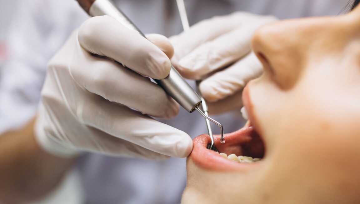 Lęk przed wizytą u dentysty – sposoby na przezwyciężenie stomatofobii